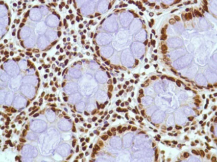 Immunohistochemistry (Formalin/PFA-fixed paraffin-embedded sections) - Anti-ERCC1 antibody [SP68] - BSA and Azide free (AB236442)