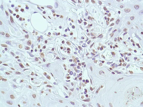 Immunohistochemistry (Formalin/PFA-fixed paraffin-embedded sections) - Anti-ERCC1 antibody [SP68] - BSA and Azide free (AB236442)