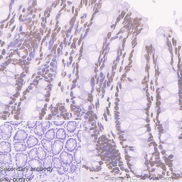 Immunohistochemistry (Formalin/PFA-fixed paraffin-embedded sections) - Anti-ERCC1 antibody [SP68] - BSA and Azide free (AB236442)