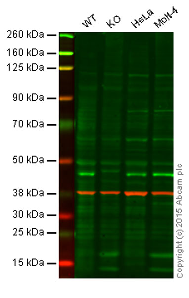 Western blot - Anti-ERCC8 antibody [EPR9237] - BSA and Azide free (AB240096), expandable thumbnail