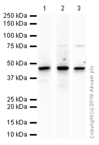Western blot - Anti-ERCC8 antibody [EPR9237] - BSA and Azide free (AB240096), expandable thumbnail