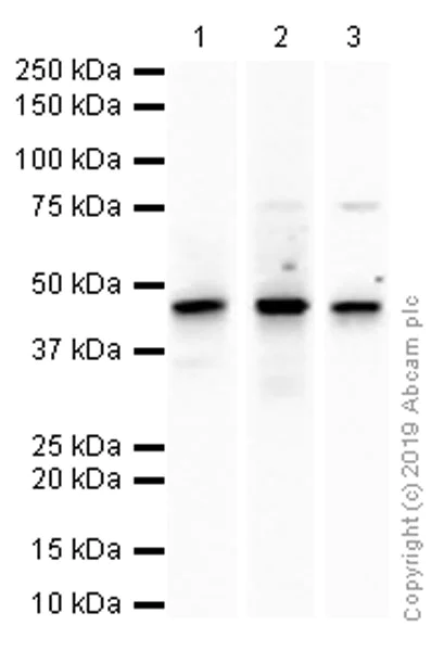 Western blot - Anti-ERCC8 antibody [EPR9237] - BSA and Azide free (AB240096)