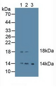 Western blot - Anti-EREG antibody (AB233512), expandable thumbnail