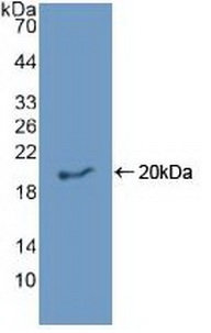 Western blot - Anti-EREG antibody (AB233512), expandable thumbnail