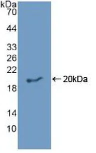 Western blot - Anti-EREG antibody (AB233512)