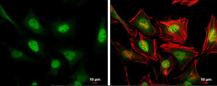 Immunocytochemistry/ Immunofluorescence - Anti-ERF antibody (AB153726)