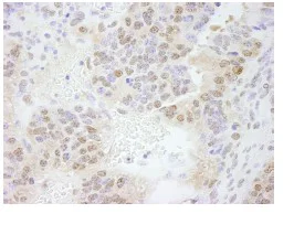Immunohistochemistry (Formalin/PFA-fixed paraffin-embedded sections) - Anti-ERF antibody (AB84773)