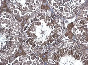 Immunohistochemistry (Formalin/PFA-fixed paraffin-embedded sections) - Anti-eRF1 antibody (AB153731)