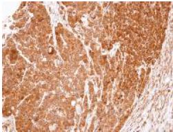Immunohistochemistry (Formalin/PFA-fixed paraffin-embedded sections) - Anti-eRF1 antibody (AB153731), expandable thumbnail