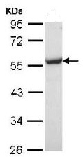 Western blot - Anti-eRF1 antibody (AB153731), expandable thumbnail