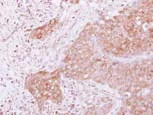 Immunohistochemistry (Formalin/PFA-fixed paraffin-embedded sections) - Anti-eRF3/GSPT1 antibody (AB126090)