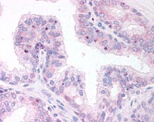 Immunohistochemistry (Formalin/PFA-fixed paraffin-embedded sections) - Anti-ERG antibody (AB115555)