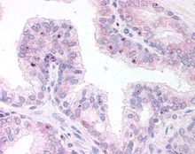 Immunohistochemistry (Formalin/PFA-fixed paraffin-embedded sections) - Anti-ERG antibody (AB115555)