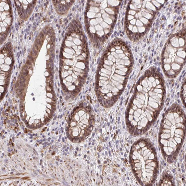 Immunohistochemistry (Formalin/PFA-fixed paraffin-embedded sections) - Anti-ERG Antibody (AB327232)