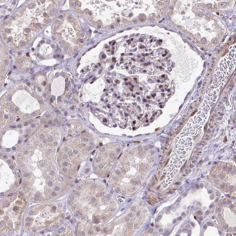 Immunohistochemistry (Formalin/PFA-fixed paraffin-embedded sections) - Anti-ERG Antibody (AB327232)