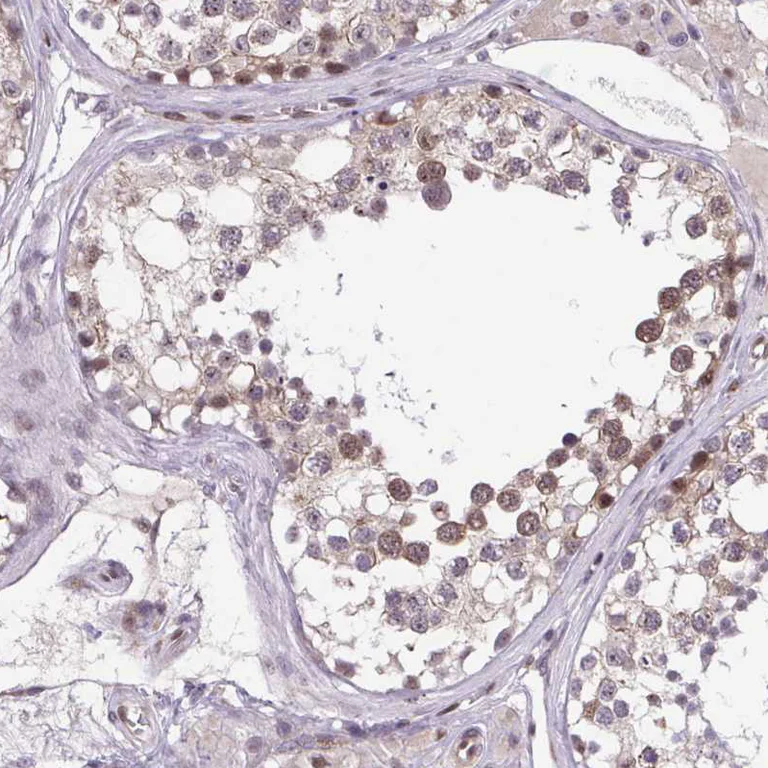 Immunohistochemistry (Formalin/PFA-fixed paraffin-embedded sections) - Anti-ERG Antibody (AB327232)