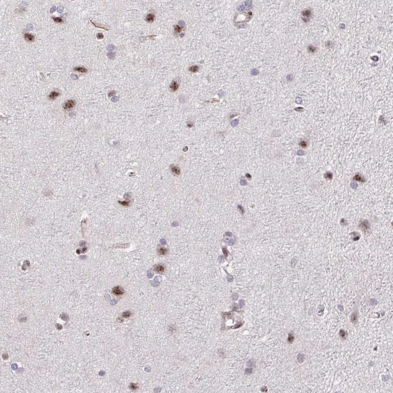 Immunohistochemistry (Formalin/PFA-fixed paraffin-embedded sections) - Anti-ERG Antibody (AB327232)