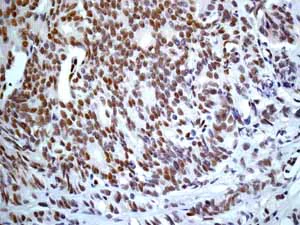 Anti-ERG antibody [EPR3864] Rabbit monoclonal (ab92513) | Abcam