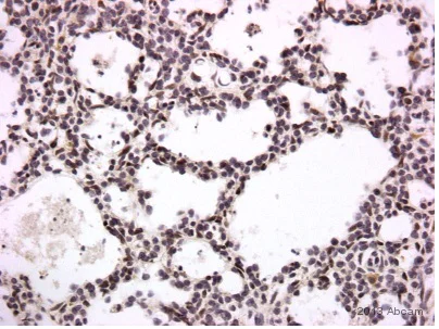 Immunohistochemistry (Formalin/PFA-fixed paraffin-embedded sections) - Anti-ERG antibody [EPR3864] (AB92513)
