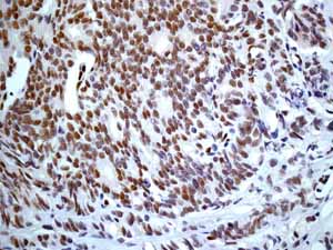 Immunohistochemistry (Formalin/PFA-fixed paraffin-embedded sections) - Anti-ERG antibody [EPR3864] - BSA and Azide free (AB214796), expandable thumbnail