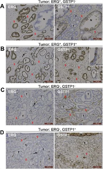 Immunohistochemistry (Formalin/PFA-fixed paraffin-embedded sections) - Anti-ERG antibody [EPR3864] - BSA and Azide free (AB214796)