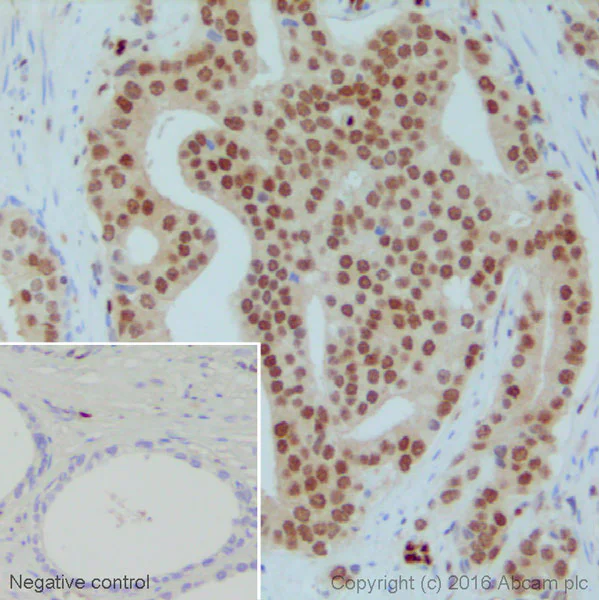 Immunohistochemistry (Formalin/PFA-fixed paraffin-embedded sections) - Anti-ERG antibody [EPR3864] - Mouse IgG2b (Chimeric) - BSA and Azide free (AB275331)