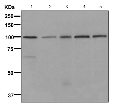 Western blot - Anti-ERG2 antibody [EPR11840] (AB170994), expandable thumbnail