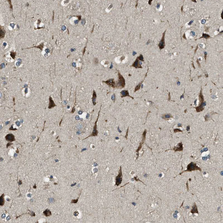 Immunohistochemistry (Formalin/PFA-fixed paraffin-embedded sections) - Anti-ERGIC1 antibody (AB121574)