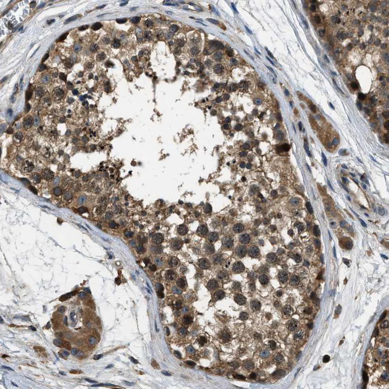 Immunohistochemistry (Formalin/PFA-fixed paraffin-embedded sections) - Anti-ERGIC1 antibody (AB121574)