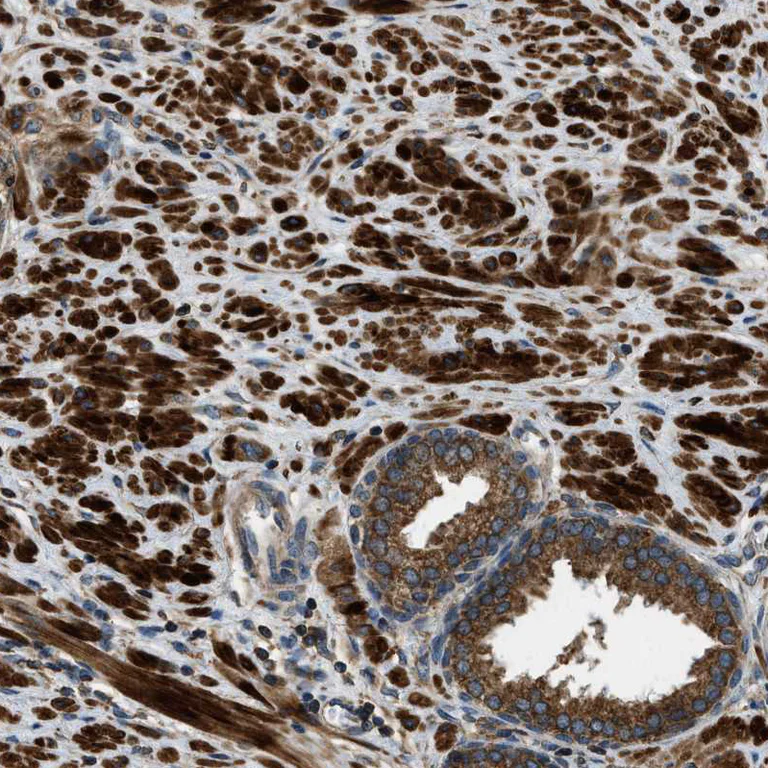 Immunohistochemistry (Formalin/PFA-fixed paraffin-embedded sections) - Anti-ERGIC1 antibody (AB121574)