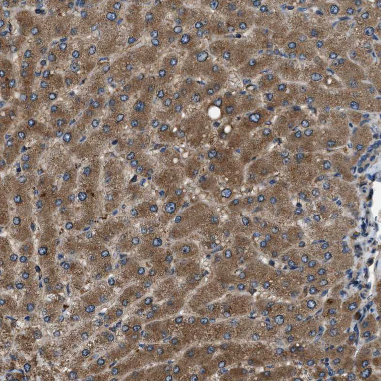 Immunohistochemistry (Formalin/PFA-fixed paraffin-embedded sections) - Anti-ERGIC1 antibody (AB121574)