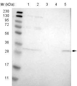Western blot - Anti-ERGIC1 antibody (AB121574)