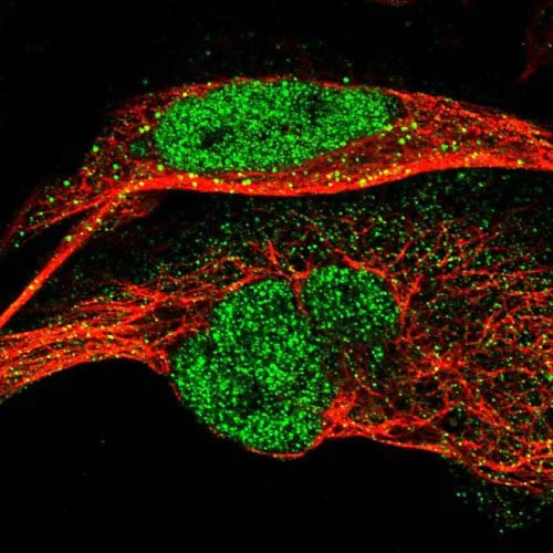 Immunocytochemistry/ Immunofluorescence - Anti-ERGIC1 antibody (AB121582)