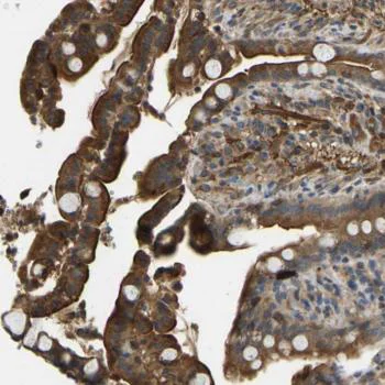 Immunohistochemistry (Formalin/PFA-fixed paraffin-embedded sections) - Anti-ERGIC1 antibody (AB121582)