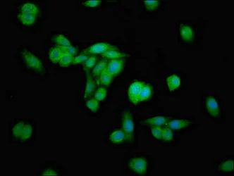 Immunocytochemistry/ Immunofluorescence - Anti-ERGIC2/PTX1 antibody (AB237761)