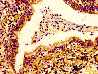 Immunohistochemistry (Formalin/PFA-fixed paraffin-embedded sections) - Anti-ERGIC2/PTX1 antibody (AB237761)