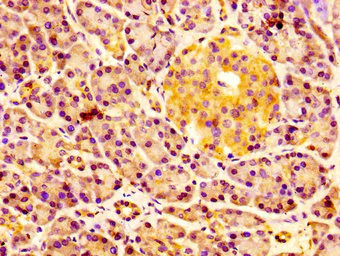 Immunohistochemistry (Formalin/PFA-fixed paraffin-embedded sections) - Anti-ERGIC2/PTX1 antibody (AB237761)