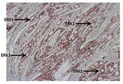 Immunohistochemistry (Formalin/PFA-fixed paraffin-embedded sections) - Anti-ERK1 antibody [12D11] (AB119357)