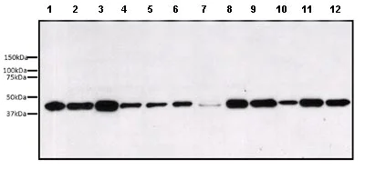 Western blot - Anti-ERK1 antibody [12D11] (AB119357)