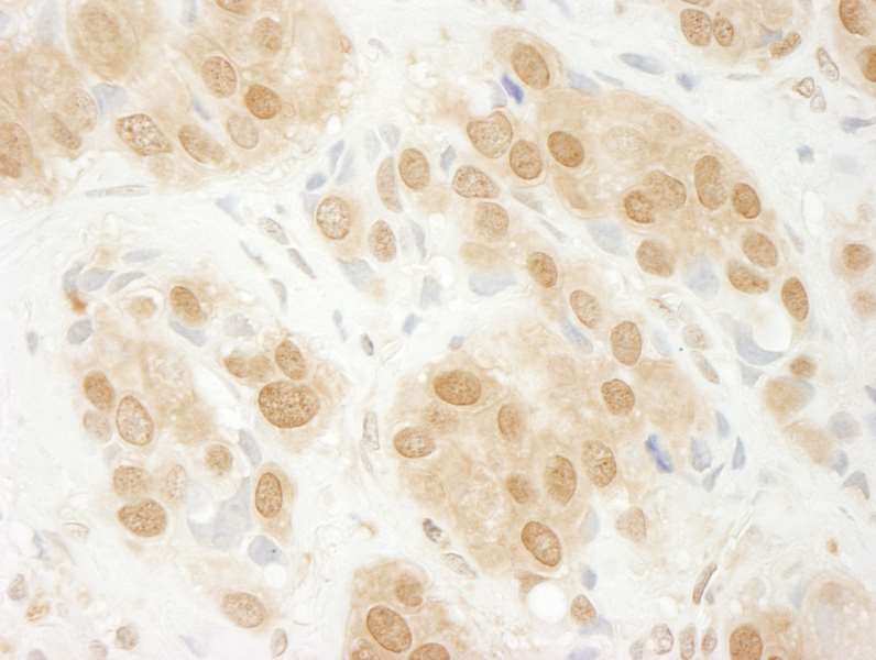 Immunohistochemistry (Formalin/PFA-fixed paraffin-embedded sections) - Anti-ERK1 antibody (AB264269), expandable thumbnail