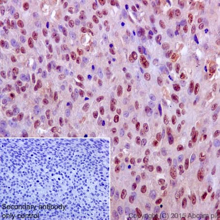Immunohistochemistry (Formalin/PFA-fixed paraffin-embedded sections) - Anti-ERK1 antibody [Y72] (AB32537), expandable thumbnail