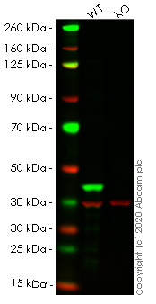 Western blot - Anti-ERK1 antibody [Y72] (AB32537), expandable thumbnail