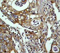 Immunohistochemistry (Formalin/PFA-fixed paraffin-embedded sections) - Anti-ERK1 antibody [Y72] - BSA and Azide free (AB214168)