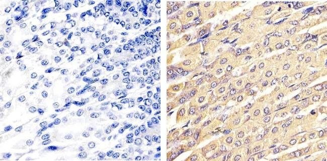 Anti-ERK1 + ERK2 antibody. Rabbit polyclonal (ab17942) | Abcam