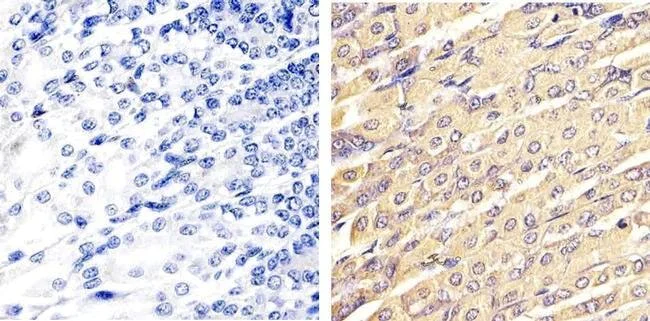 Anti-ERK1 + ERK2 antibody. Rabbit polyclonal (ab17942) | Abcam
