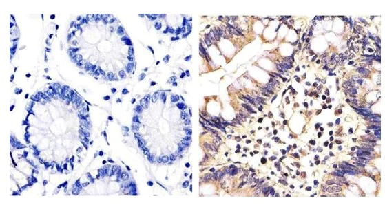 Immunohistochemistry (Formalin/PFA-fixed paraffin-embedded sections) - Anti-ERK1 + ERK2 antibody (AB17942)