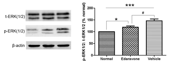 erk 様 Phospho-ERK1+ERK2 (Thr202 / Tyr204) antibody (IR188-706