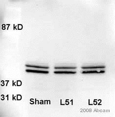 Anti-ERK1 + ERK2 antibody. Rabbit polyclonal (ab17942) | Abcam
