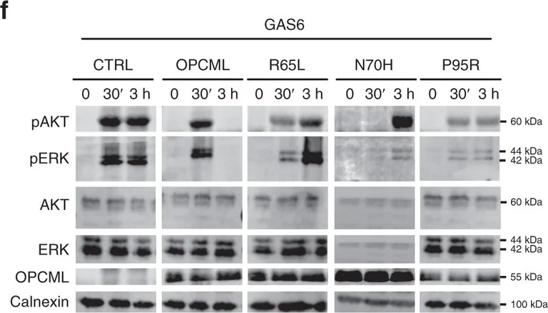 Western blot - Anti-ERK1 + ERK2 antibody (AB17942)