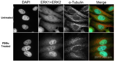 Immunocytochemistry/ Immunofluorescence - Anti-ERK1 + ERK2 antibody [EPR17526] (AB184699), expandable thumbnail